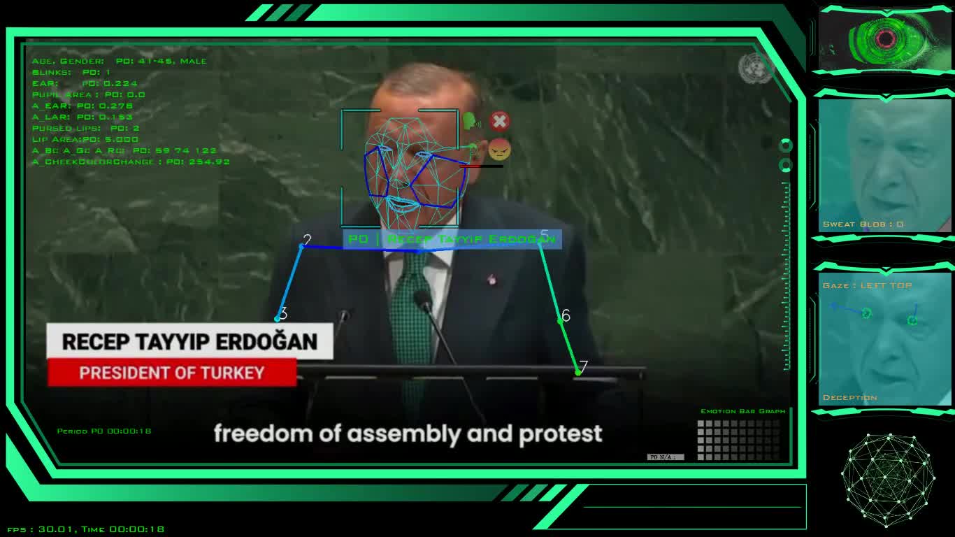 Erdogan to UN: